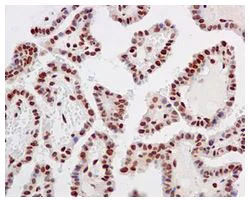 Immunohistochemistry (Formalin/PFA-fixed paraffin-embedded sections) - Anti-RECQ1 antibody [EPR8049(2)] - BSA and Azide free (AB249704)