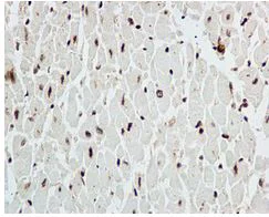 Immunohistochemistry (Formalin/PFA-fixed paraffin-embedded sections) - Anti-RECQ1 antibody [EPR8049(2)] - BSA and Azide free (AB249704)