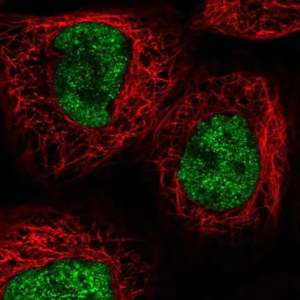 Immunocytochemistry/ Immunofluorescence - Anti-RECQL4 antibody (AB188125)