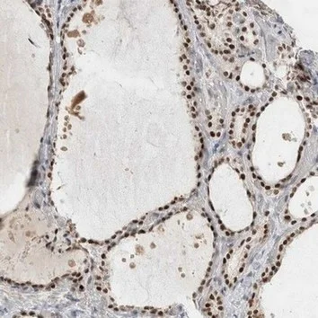 Immunohistochemistry (Formalin/PFA-fixed paraffin-embedded sections) - Anti-RECQL4 antibody (AB188125)