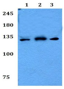 Western blot - Anti-RECQL4 antibody (AB192375)