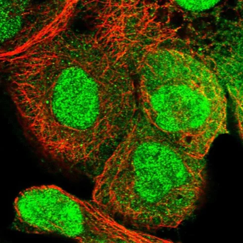 Immunocytochemistry/ Immunofluorescence - Anti-RECQL5 antibody (AB224135)