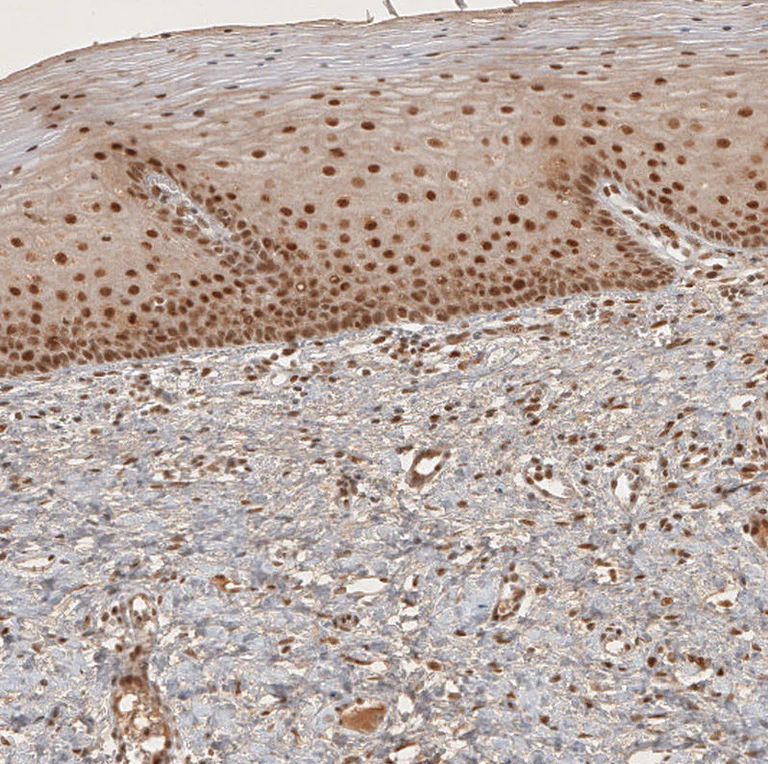 Immunohistochemistry (Formalin/PFA-fixed paraffin-embedded sections) - Anti-RECQL5 antibody (AB224135)