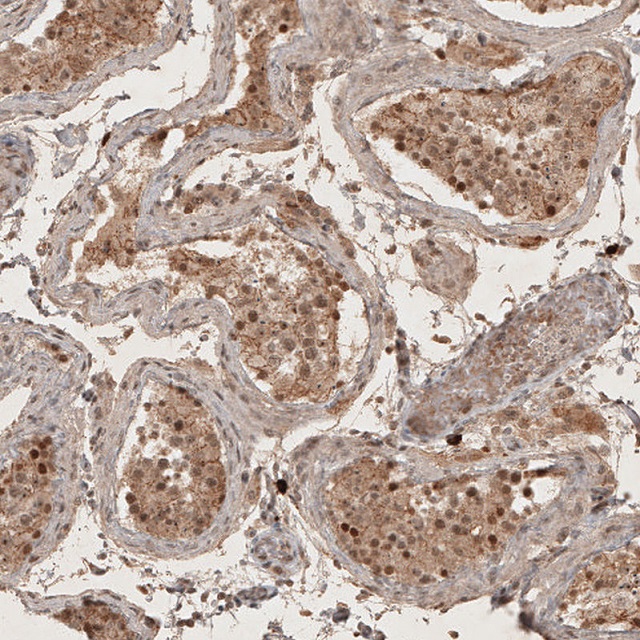 Immunohistochemistry (Formalin/PFA-fixed paraffin-embedded sections) - Anti-RECQL5 antibody (AB224135)