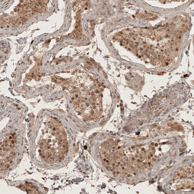 Immunohistochemistry (Formalin/PFA-fixed paraffin-embedded sections) - Anti-RECQL5 antibody (AB224135)