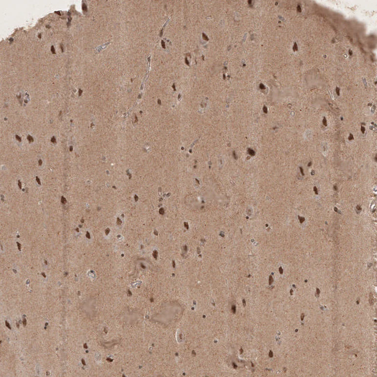Immunohistochemistry (Formalin/PFA-fixed paraffin-embedded sections) - Anti-RECQL5 antibody (AB224135)