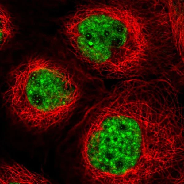 Immunocytochemistry/ Immunofluorescence - Anti-RED antibody (AB204170)