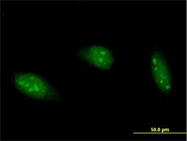 Immunocytochemistry/ Immunofluorescence - Anti-RED1 antibody (AB89436), expandable thumbnail