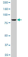 Western blot - Anti-RED1 antibody (AB89436)