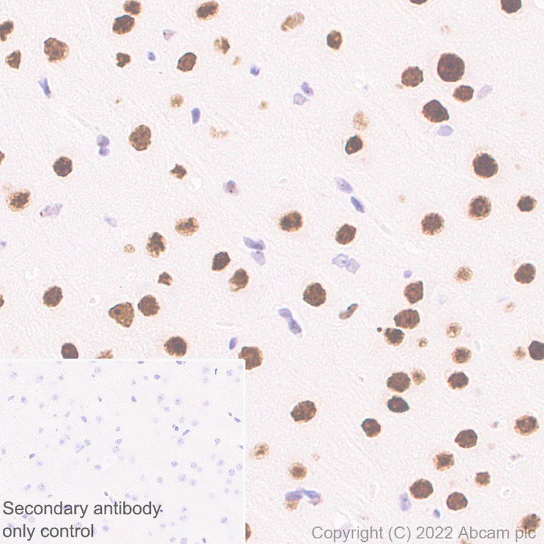 Immunohistochemistry (Formalin/PFA-fixed paraffin-embedded sections) - Anti-RED1 antibody [EPR25433-101] (AB290638)