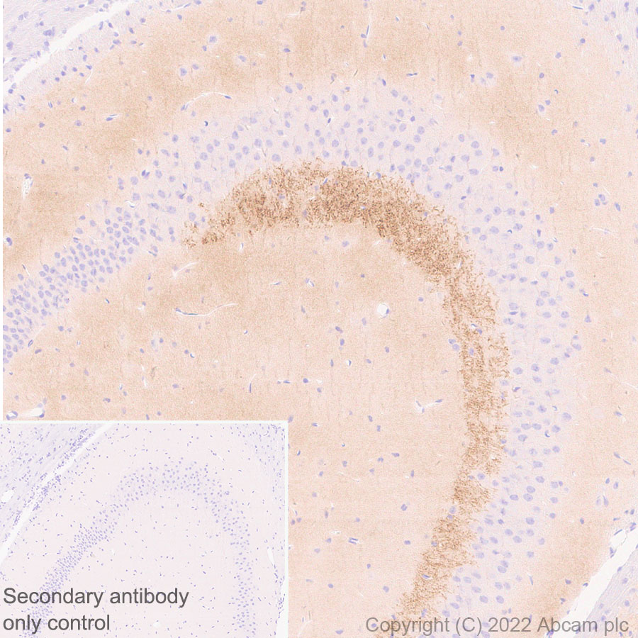 Immunohistochemistry (Formalin/PFA-fixed paraffin-embedded sections) - Anti-RED1 + RED2 antibody [EPR26577-102] (AB307893), expandable thumbnail