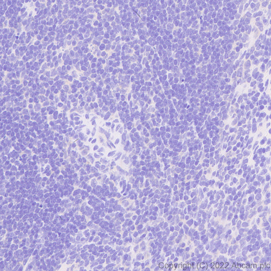 Immunohistochemistry (Formalin/PFA-fixed paraffin-embedded sections) - Anti-RED1 + RED2 antibody [EPR26577-102] (AB307893), expandable thumbnail