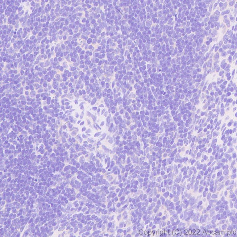 Immunohistochemistry (Formalin/PFA-fixed paraffin-embedded sections) - Anti-RED1 + RED2 antibody [EPR26577-102] (AB307893)