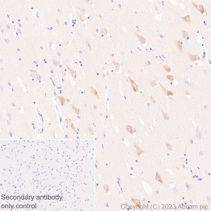 Immunohistochemistry (Formalin/PFA-fixed paraffin-embedded sections) - Anti-Reelin antibody [EPR26278-30] (ab312310), expandable thumbnail