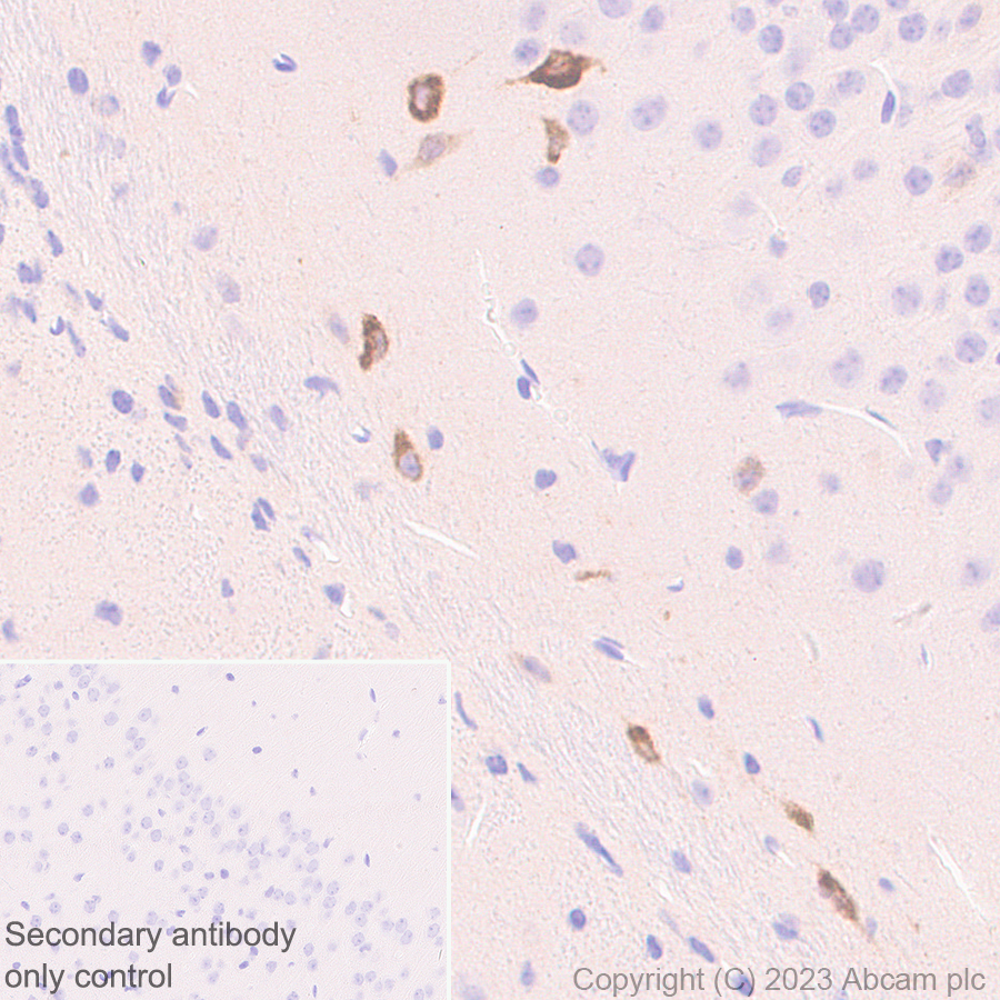Immunohistochemistry (Formalin/PFA-fixed paraffin-embedded sections) - Anti-Reelin antibody [EPR26278-30] (ab312310), expandable thumbnail