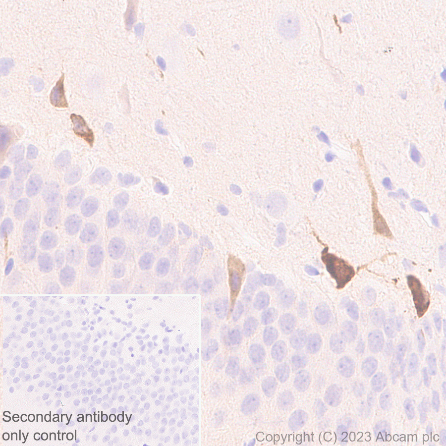 Immunohistochemistry (Formalin/PFA-fixed paraffin-embedded sections) - Anti-Reelin antibody [EPR26278-30] (ab312310), expandable thumbnail
