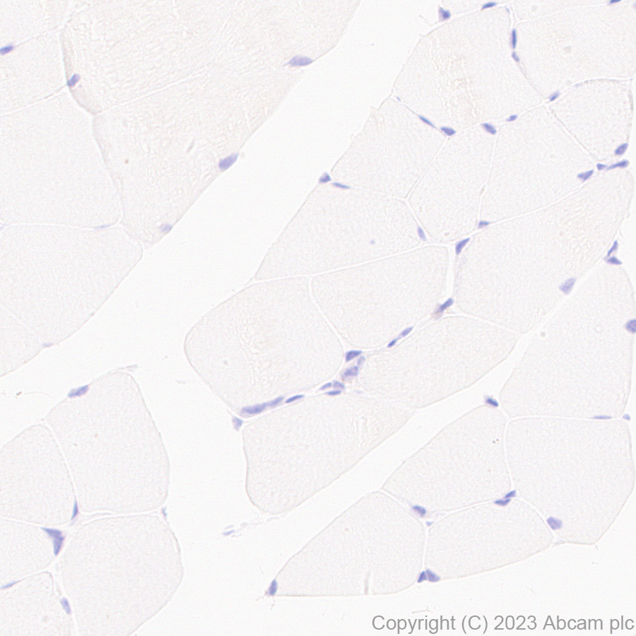 Immunohistochemistry (Formalin/PFA-fixed paraffin-embedded sections) - Anti-Reelin antibody [EPR26278-30] (ab312310), expandable thumbnail