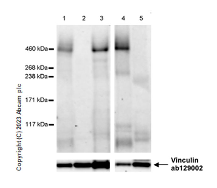 Western blot - Anti-Reelin antibody [EPR26278-30] (AB312310), expandable thumbnail