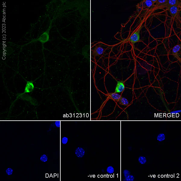 Immunocytochemistry/ Immunofluorescence - Anti-Reelin antibody [EPR26278-30] - BSA and Azide free (AB312311)