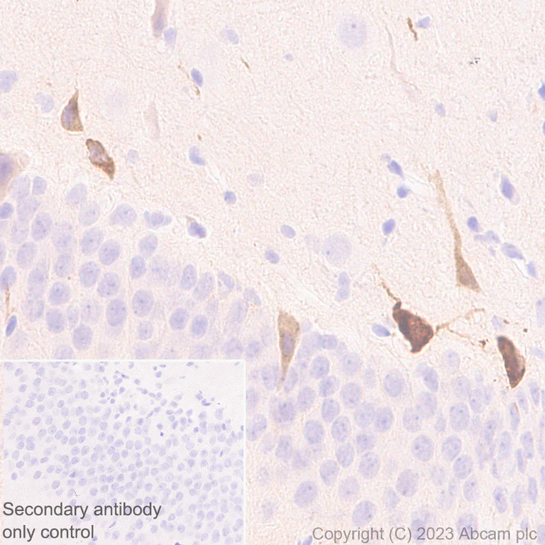 Immunohistochemistry (Formalin/PFA-fixed paraffin-embedded sections) - Anti-Reelin antibody [EPR26278-30] - BSA and Azide free (AB312311)