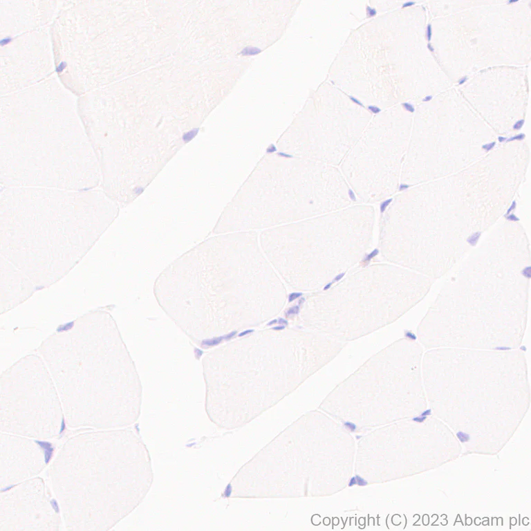 Immunohistochemistry (Formalin/PFA-fixed paraffin-embedded sections) - Anti-Reelin antibody [EPR26278-30] - BSA and Azide free (AB312311)