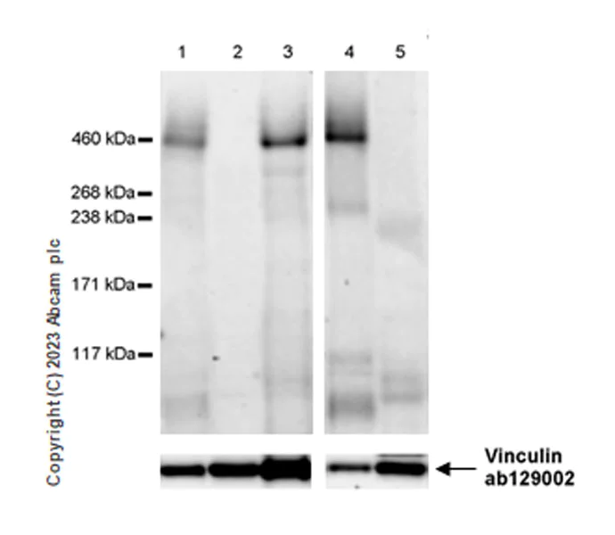 Western blot - Anti-Reelin antibody [EPR26278-30] - BSA and Azide free (AB312311)