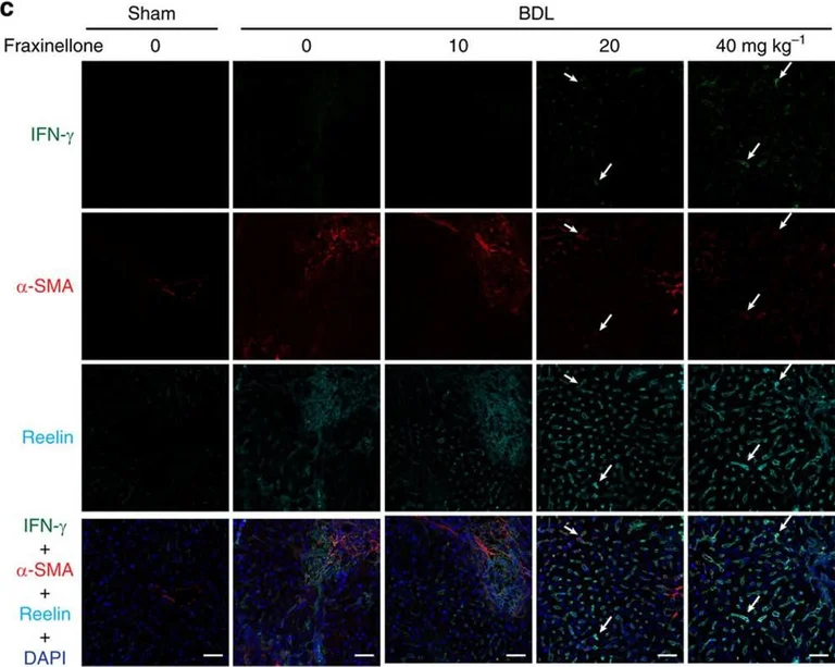 Immunohistochemistry - Anti-Reelin antibody [G10] (AB78540)