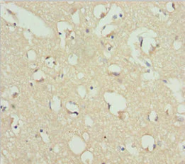 Immunohistochemistry (Formalin/PFA-fixed paraffin-embedded sections) - Anti-REEP1 antibody (AB230026)