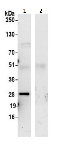 Immunoprecipitation - Anti-REEP3 antibody (AB241964)