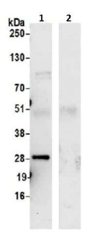 Immunoprecipitation - Anti-REEP3 antibody (AB241964)