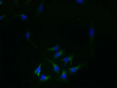 Immunocytochemistry/ Immunofluorescence - Anti-REEP4 antibody (AB237689)