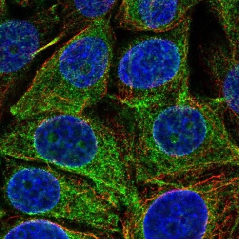 Immunocytochemistry/ Immunofluorescence - Anti-REEP5 antibody (AB221810)