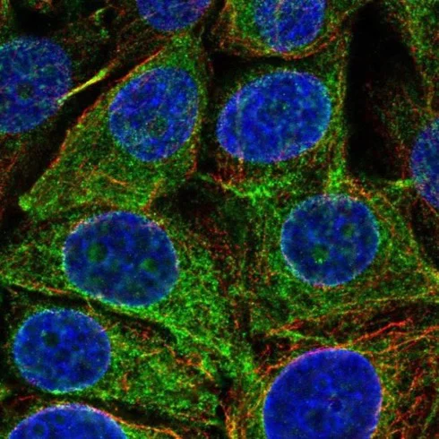 Immunocytochemistry/ Immunofluorescence - Anti-REEP5 antibody (AB221810)