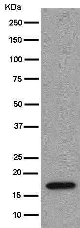 Western blot - Anti-REEP5 antibody [EP11115] (AB186755)