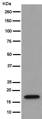 Western blot - Anti-REEP5 antibody [EP11115] (AB186755)
