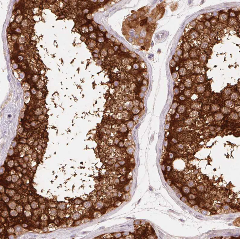 Immunohistochemistry (Formalin/PFA-fixed paraffin-embedded sections) - Anti-REEP6 antibody (AB204341)
