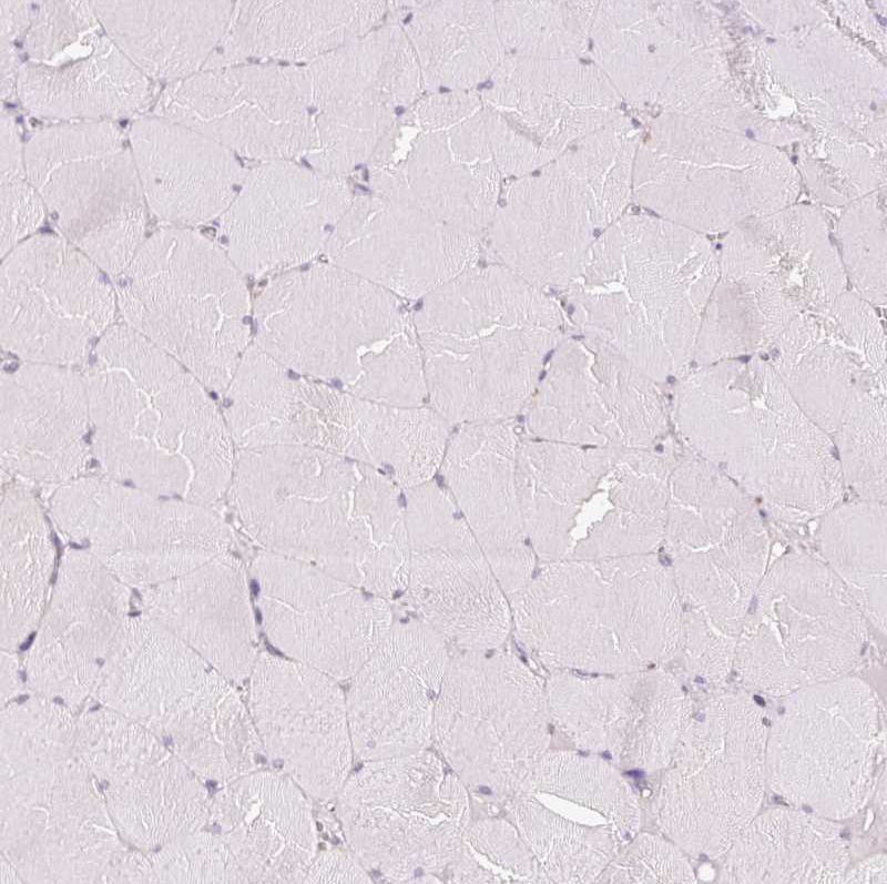 Immunohistochemistry (Formalin/PFA-fixed paraffin-embedded sections) - Anti-REEP6 antibody (ab204341), expandable thumbnail