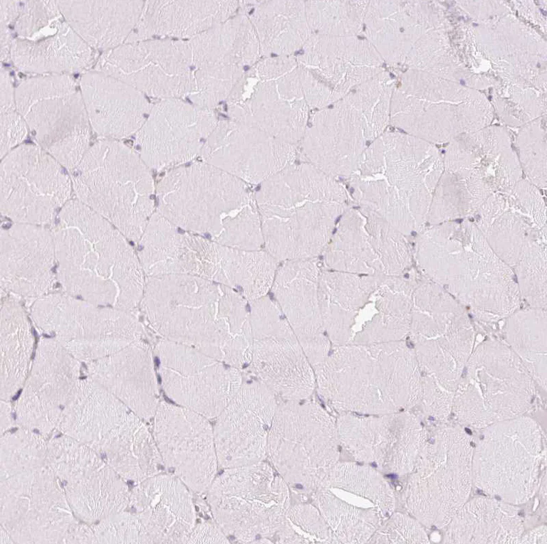Immunohistochemistry (Formalin/PFA-fixed paraffin-embedded sections) - Anti-REEP6 antibody (AB204341)