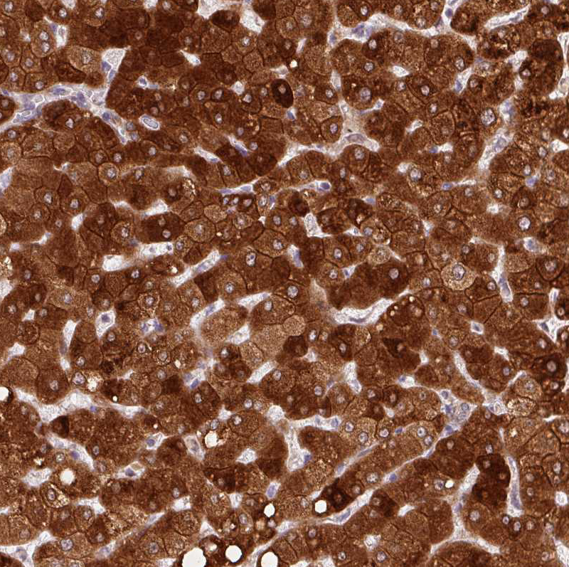 Immunohistochemistry (Formalin/PFA-fixed paraffin-embedded sections) - Anti-REEP6 antibody (AB204341), expandable thumbnail