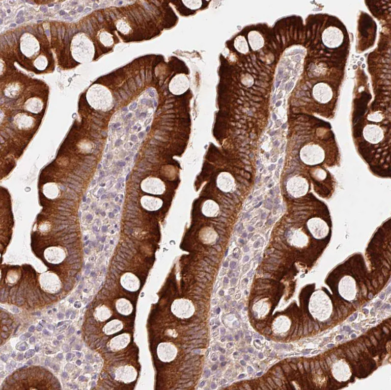 Immunohistochemistry (Formalin/PFA-fixed paraffin-embedded sections) - Anti-REEP6 antibody (AB204341)