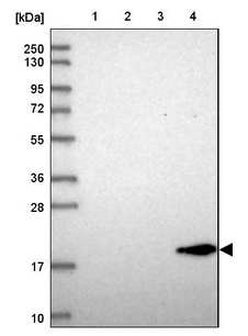 Western blot - Anti-REEP6 antibody (AB204341), expandable thumbnail