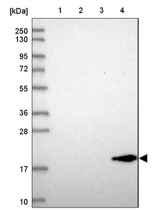 Western blot - Anti-REEP6 antibody (AB204341)