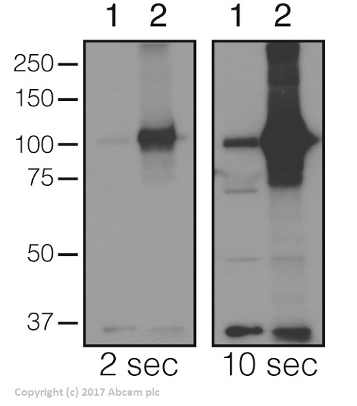 Western blot - Anti-Ref2P antibody (AB178440)