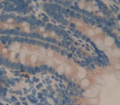 Immunohistochemistry (Formalin/PFA-fixed paraffin-embedded sections) - Anti-REG1 alpha antibody (AB231092)