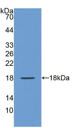 Western blot - Anti-REG1 alpha antibody (AB231092)