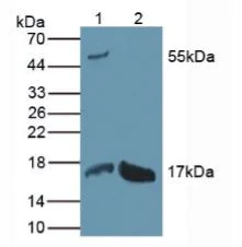 Western blot - Anti-REG1 alpha antibody (AB231092)