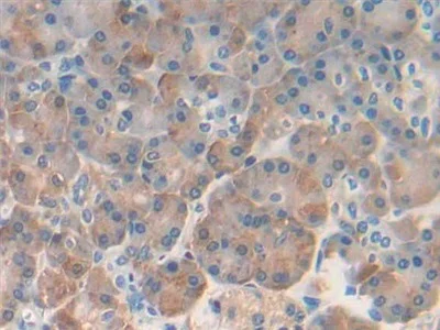 Immunohistochemistry (Formalin/PFA-fixed paraffin-embedded sections) - Anti-REG1B antibody (AB233210)