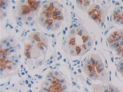 Immunohistochemistry (Formalin/PFA-fixed paraffin-embedded sections) - Anti-REG1B antibody (AB233210)