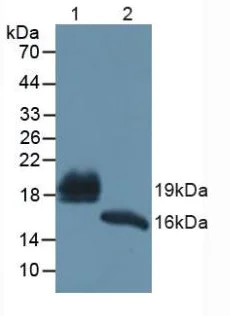 Western blot - Anti-REG1B antibody (AB233210)