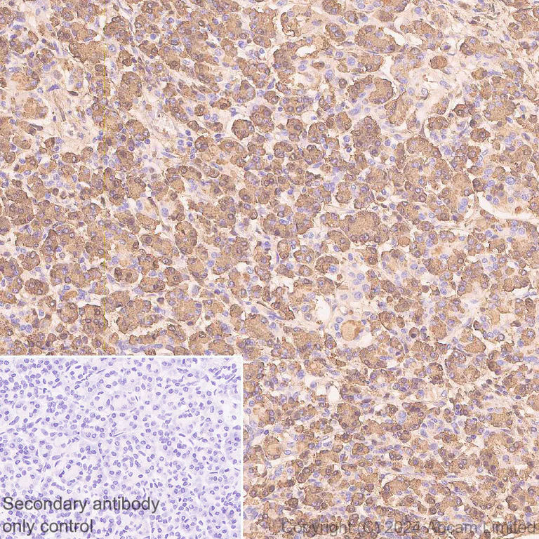 Immunohistochemistry (Formalin/PFA-fixed paraffin-embedded sections) - Anti-REG1B antibody [EPR28864-4] (AB323315)